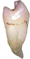 Dens_Evaginatus_Md_2nd_Premolar_Mesial_BC.jpg