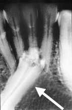 impaction_4.3_Resorption_UM_Arrow.jpg