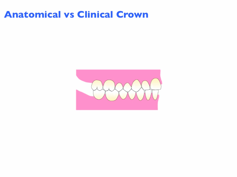 anatomical_vs_clinical_crownHB_Image.png