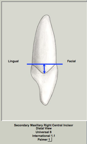 Permanent Maxillary Incisors